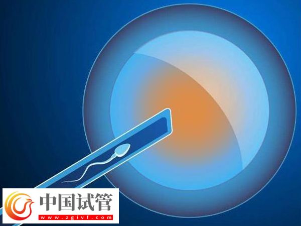 攀枝花試管醫院哪家好(圖1)