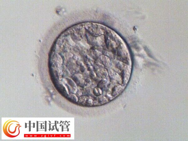 試管一次不成功二次移植費用多少(圖3) 試管一次不成功二次移植費用多少(圖3)