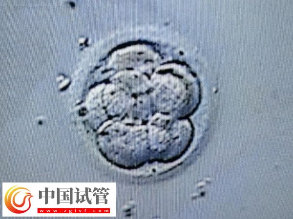試管一次不成功二次移植費用多少(圖2) 試管一次不成功二次移植費用多少(圖2)