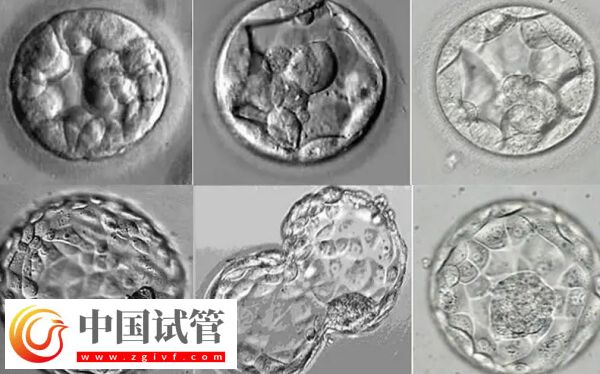 移植囊胚容易變成雙胞胎是怎么回事(圖1) 移植囊胚容易變成雙胞胎是怎么回事(圖1)