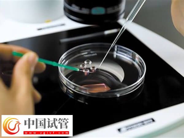 精子活力低做試管怎么辦(圖2) 精子活力低做試管怎么辦(圖2)