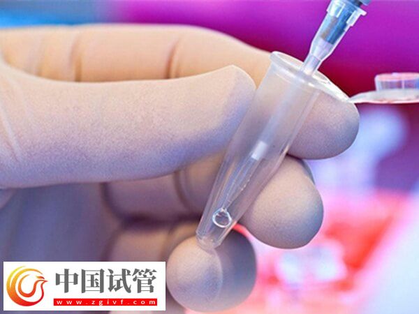 試管嬰兒哪個步驟最疼(圖3)