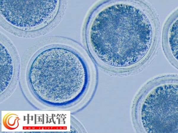 促排卵后卵泡不長怎么辦(圖1) 促排卵后卵泡不長怎么辦(圖1)