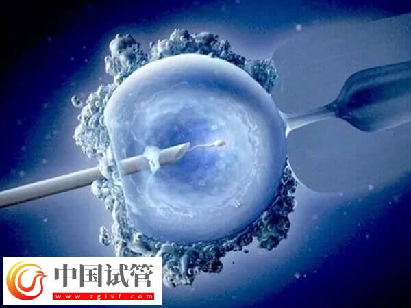 試管嬰兒CET和FET是什么意思(圖2) 試管嬰兒CET和FET是什么意思(圖2)