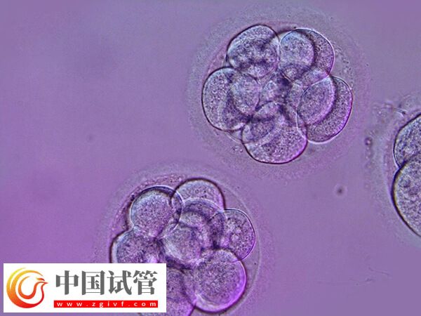 哪些人適合移植囊胚(圖2)