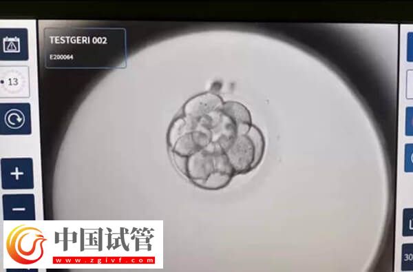 做二代試管為什么老配成c級胚胎(圖1)