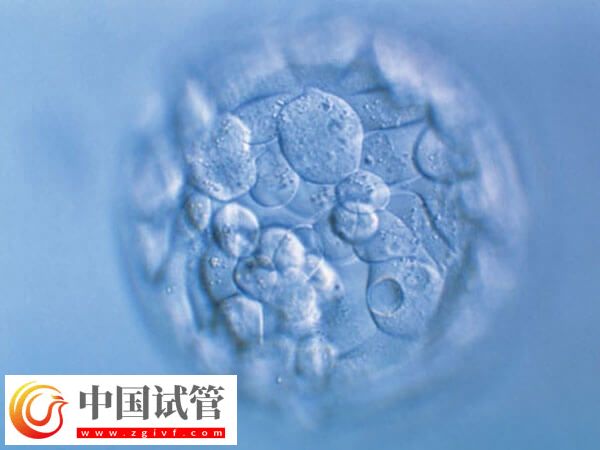 鮮胚和凍胚移植哪個好(圖1) 鮮胚和凍胚移植哪個好(圖1)