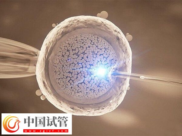 成都做試管嬰兒哪家好(圖3)