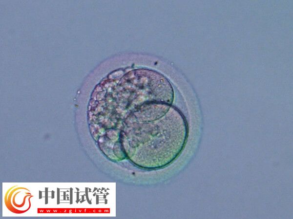 移植囊胚是不是容易生下雙胞胎(圖2) 移植囊胚是不是容易生下雙胞胎(圖2)