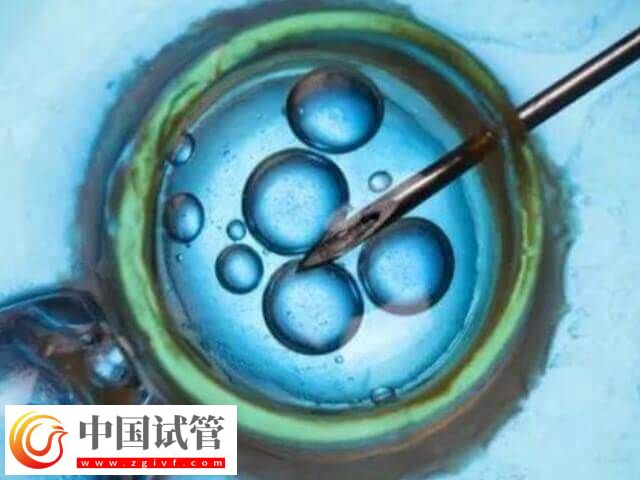 上海試管醫院排名前十名(圖1)