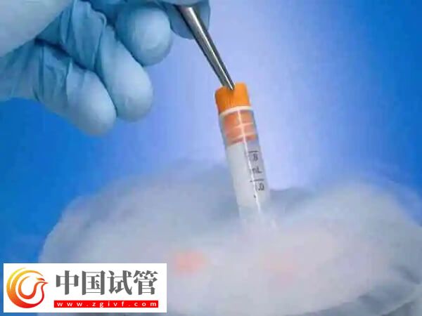 53歲高齡女性做試管嬰兒(圖2) 53歲高齡女性做試管嬰兒(圖2)