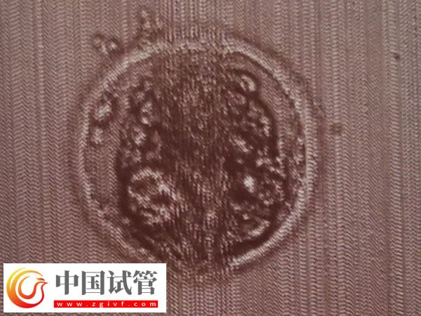 第7天囊胚4Bb有無必要移植(圖1)