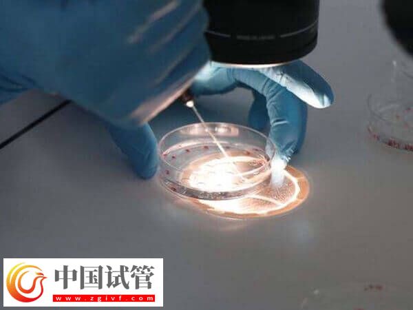 養囊成功送檢還有沒有風險(圖2)