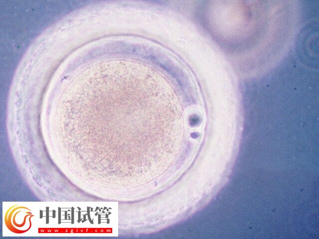 黃體期取卵是不是不可以移植鮮胚(圖2)
