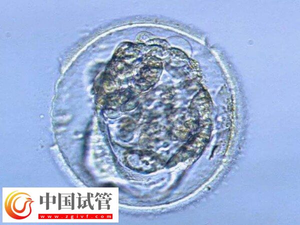 黃體期取卵是不是不可以移植鮮胚(圖1)