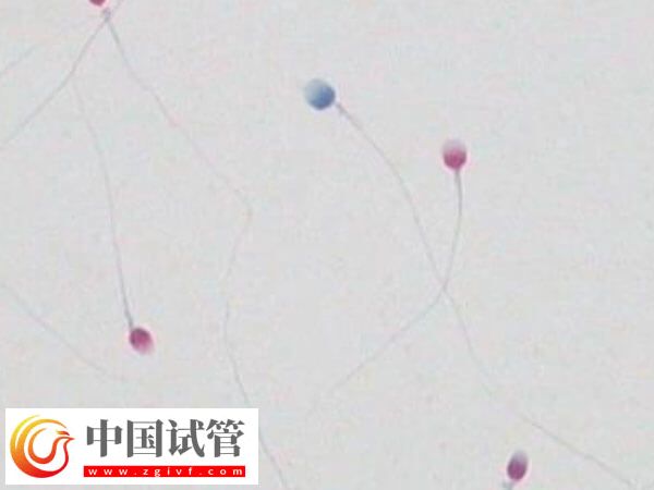 精子碎片報告是什么樣的(圖1) 精子碎片報告是什么樣的(圖1)