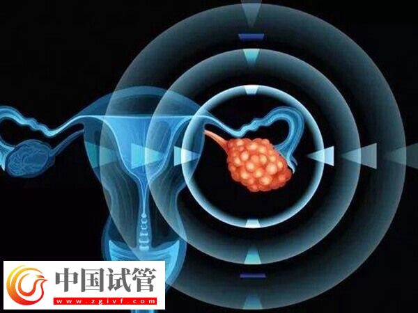 24歲卵巢早衰醫生說不用治怎么回事(圖1)