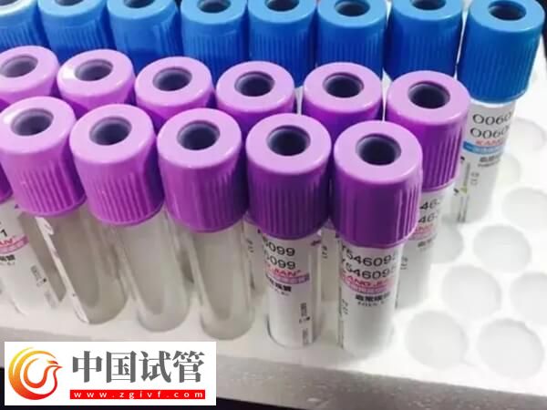 amh低會不會有優(yōu)勢卵泡發(fā)育(圖1) amh低會不會有優(yōu)勢卵泡發(fā)育(圖1)