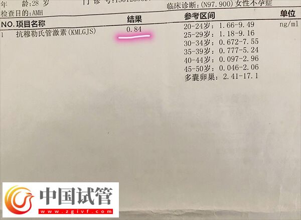 amh低會不會有優(yōu)勢卵泡發(fā)育(圖2) amh低會不會有優(yōu)勢卵泡發(fā)育(圖2)