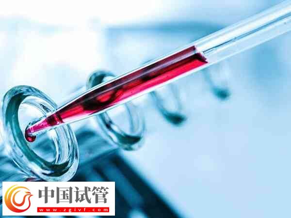 amh0.01是不是卵巢徹底衰老了!(圖2) amh0.01是不是卵巢徹底衰老了!(圖2)