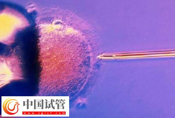 amh0.01試管有沒有成功的(圖2) amh0.01試管有沒有成功的(圖2)