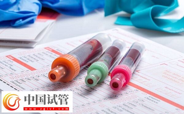 amh0.01試管有沒有成功的(圖1) amh0.01試管有沒有成功的(圖1)