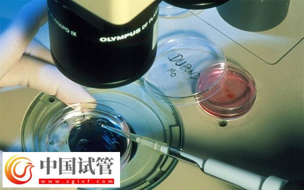 ivf和icsi的區(qū)別是什么(圖2) ivf和icsi的區(qū)別是什么(圖2)