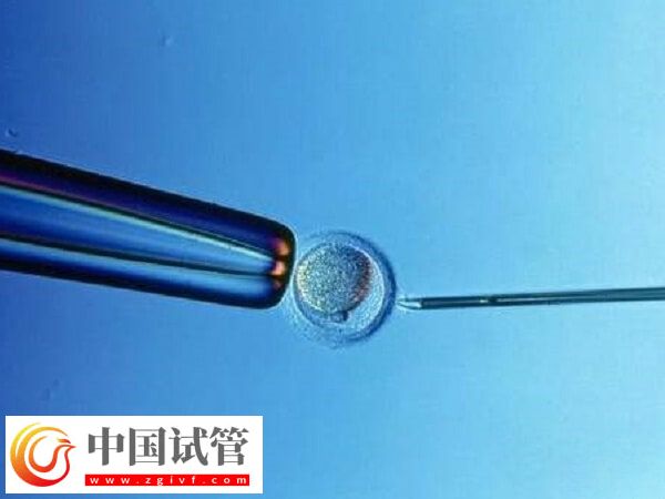 北京試管嬰兒成功率最高的醫(yī)院是哪個(gè)(圖1) 北京試管嬰兒成功率最高的醫(yī)院是哪個(gè)(圖1)