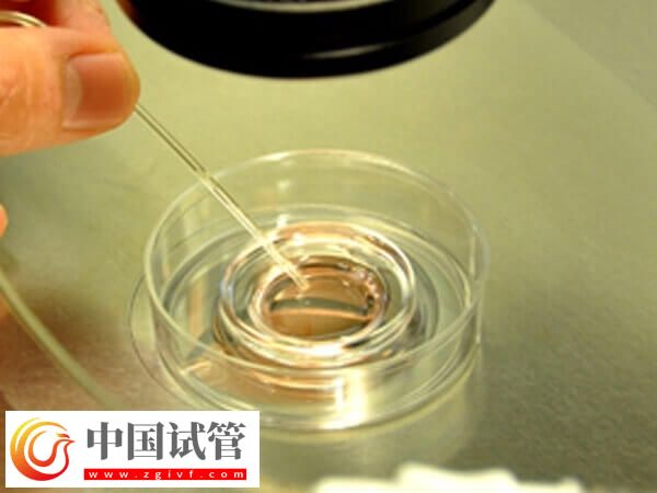 鮮胚移植失敗會不會腹痛和流血(圖1)