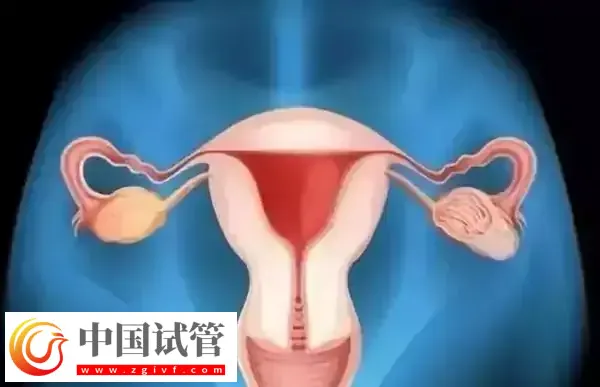 腹腔鏡子宮切除手術怎么做(圖1) 腹腔鏡子宮切除手術怎么做(圖1)