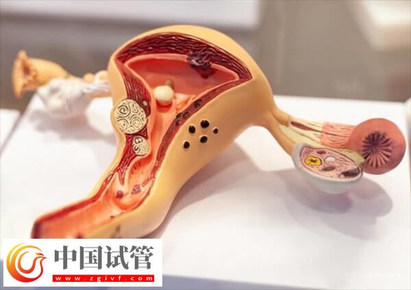 子宮肌瘤女性不能吃的食物有哪些(圖1) 子宮肌瘤女性不能吃的食物有哪些(圖1)